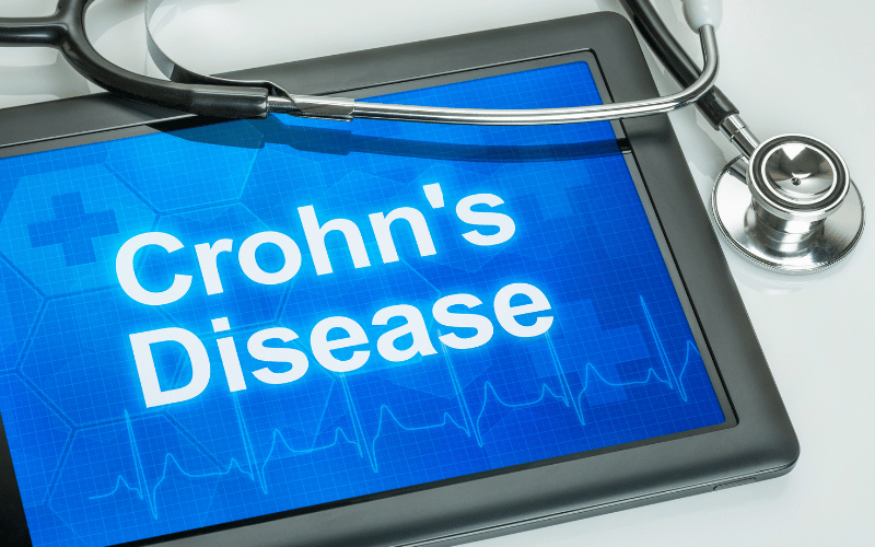 10 Unmistakable Crohn's Disease Symptoms You Shouldn't Ignore