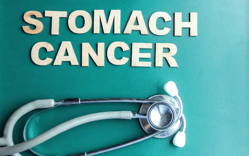 10 Vital Facts About Stomach Cancer (Gastric Cancer) Prognosis Everyone Should Know