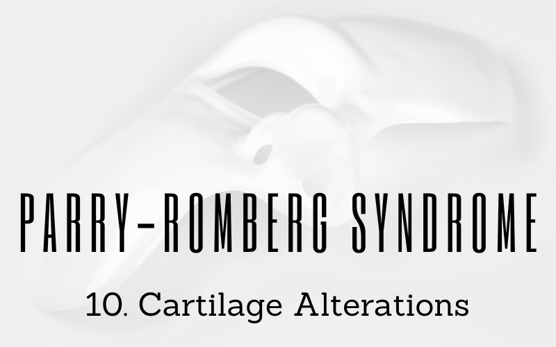 Cartilage Alterations The Ears Lose Their Symmetry