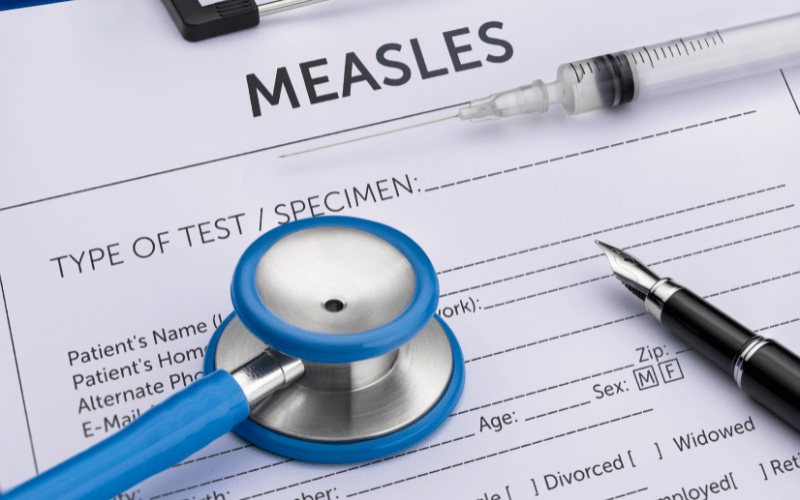 15 Essential Facts About Measles (Rubeola) Everyone Should Know