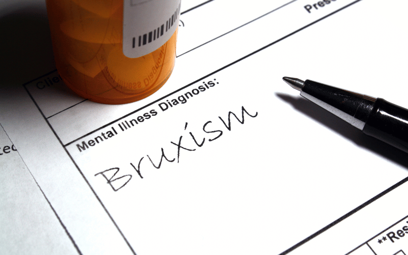 15 Important Facts About Bruxism Every Individual Should Know