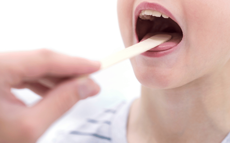 Sore Mouth and Tongue The Painful Reality of Oral Thrush