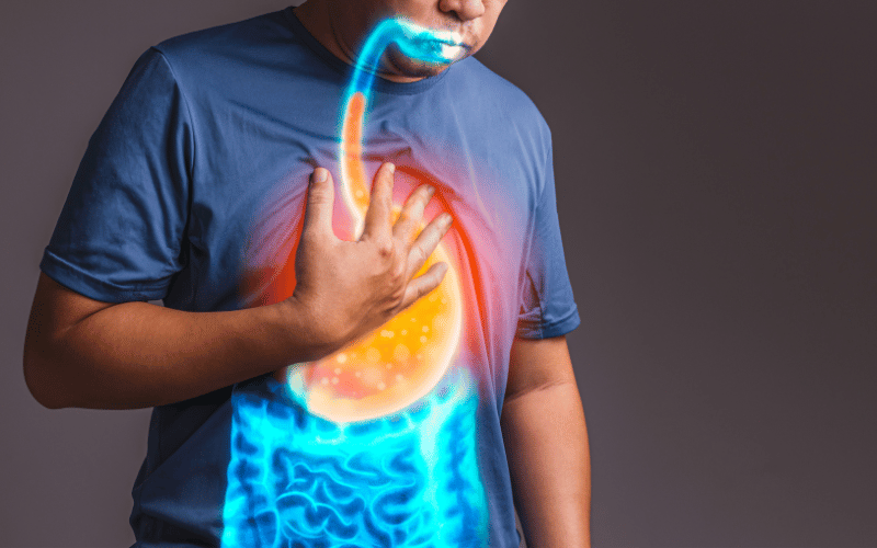 Acid Reflux The Fire Within