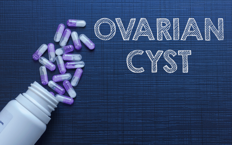 Ovarian Cysts A Silent Drama in the Female Reproductive System