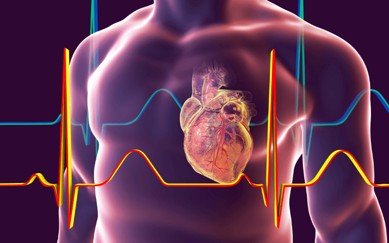 Cardiovascular Complications - More Than Just a Flutter