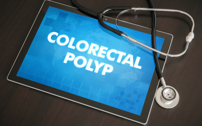 Decoding the 10 Symptoms of Colon Polyps (Colorectal Polyps)
