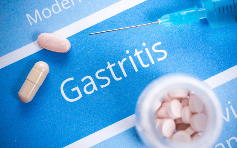 FAQs about Gastritis Healing