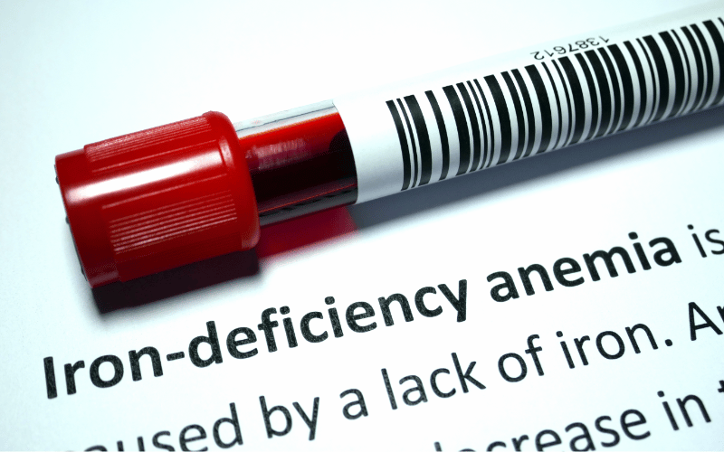 Iron-Deficiency Anemia - More Than Just Fatigue