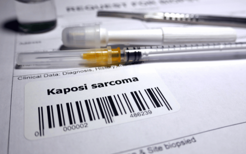 Kaposi's Sarcoma