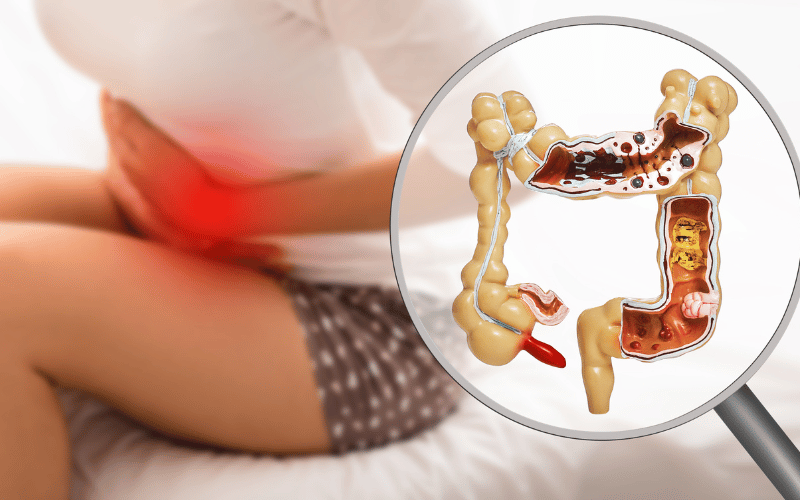 Pain or Growth in the Abdomen