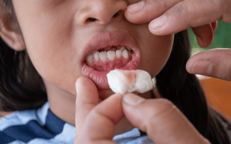 Painful Gums - Especially Hard for the Young Ones