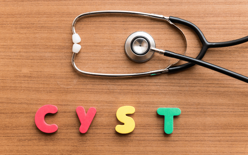 Presence of Additional Cysts