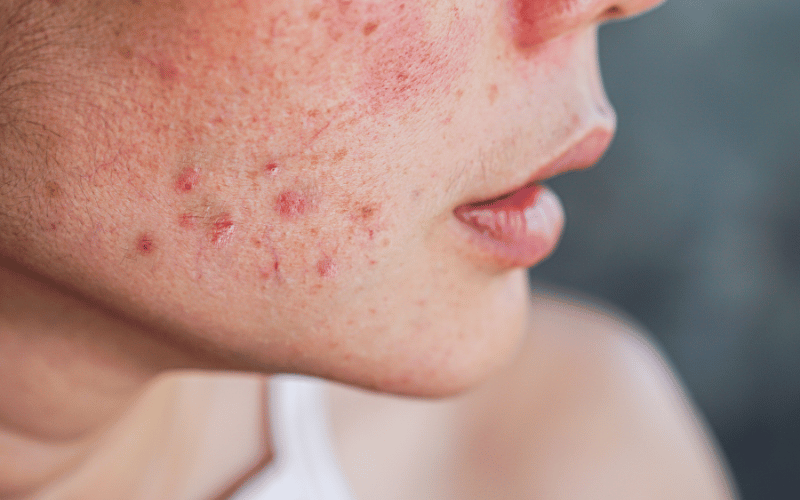 Red Patches Beyond Simple Rashes