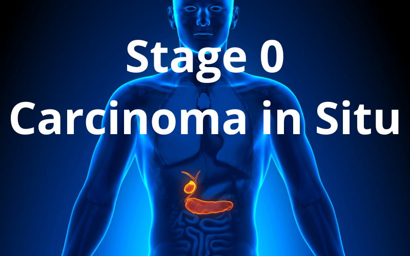 Stage 0 (Carcinoma in Situ) Unraveling the Initial Symptoms