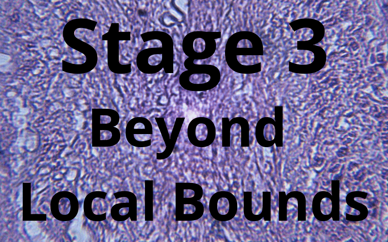 Stage 3 Beyond Local Bounds