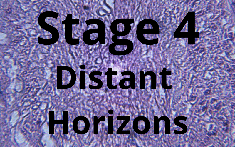 Stage 4 Distant Horizons