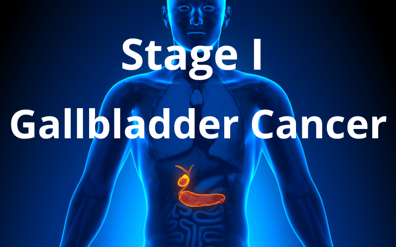 Stage I Gallbladder Cancer The Quiet Advance