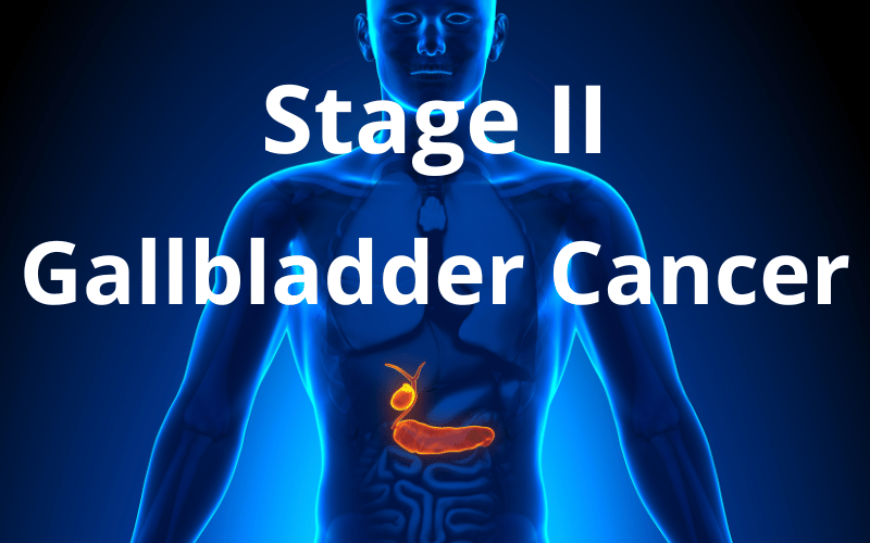 Understanding the 5 Stages of Gallbladder Cancer - Page 3 of 6