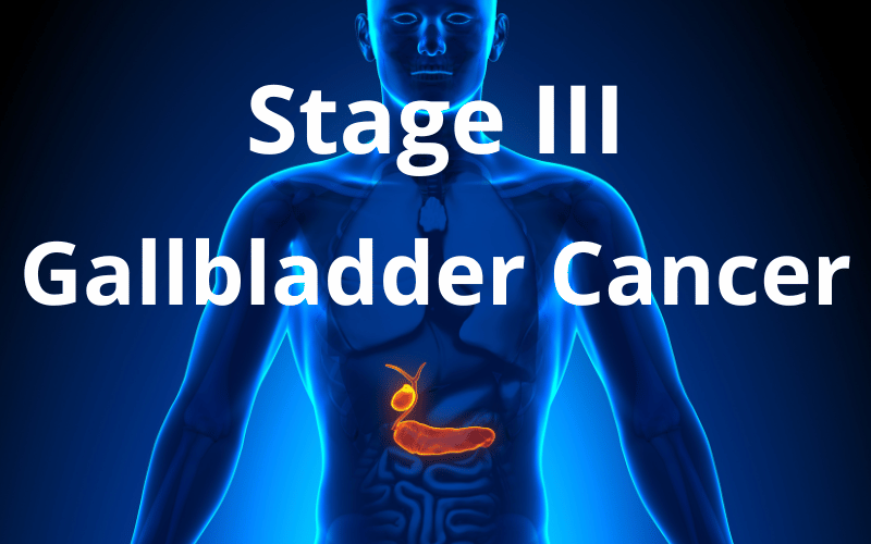 Stage III Gallbladder Cancer The Imminent Threat