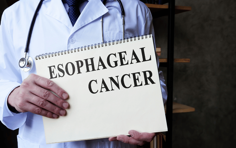 The Esophageal Ulcer and Cancer Connection