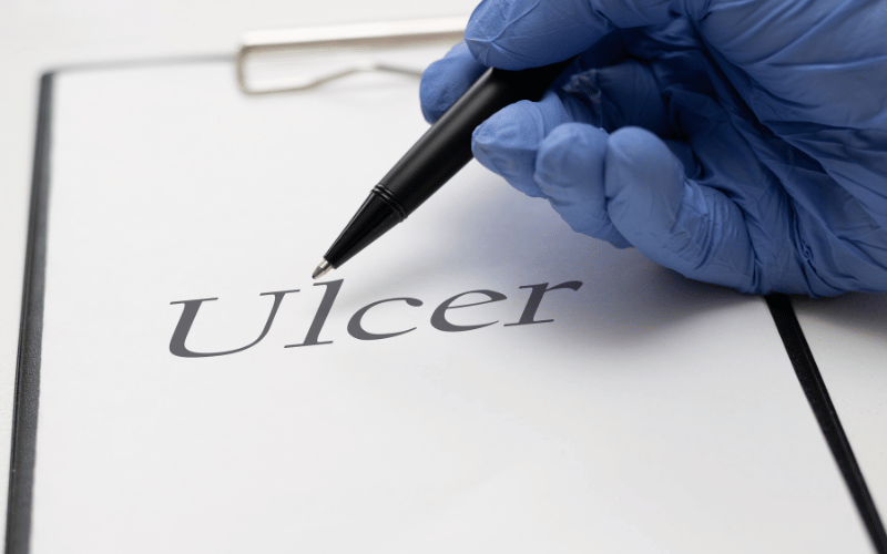 The Reality of Ulcer Recurrence