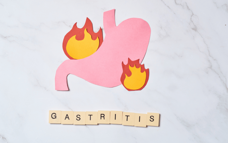 The Silent Specter - Asymptomatic Gastritis