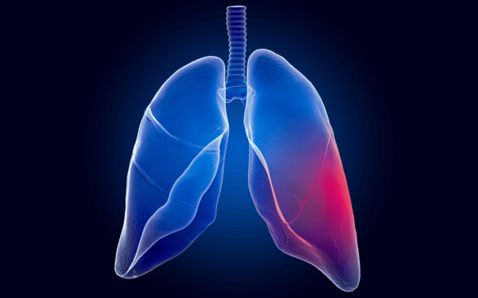 Understanding Childhood Lung Carcinoma: 10 Warning Symptoms Every ...