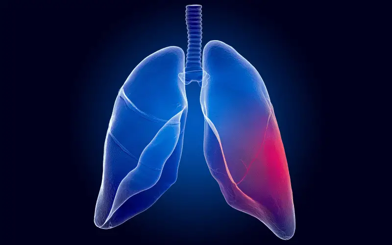 Understanding Childhood Lung Carcinoma 10 Warning Symptoms Every Parent Should Know