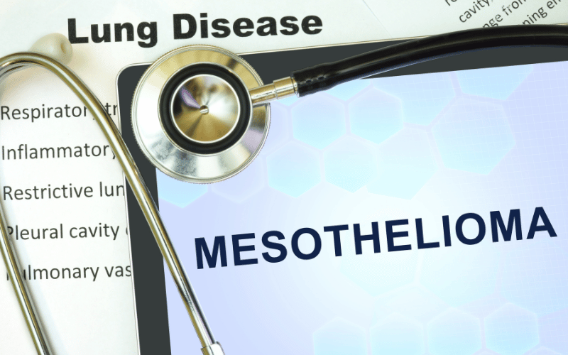 Understanding Mesothelioma