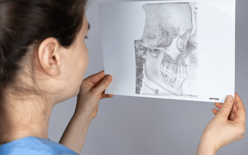 Understanding TMD 10 Symptoms of Temporomandibular Joint Dysfunction