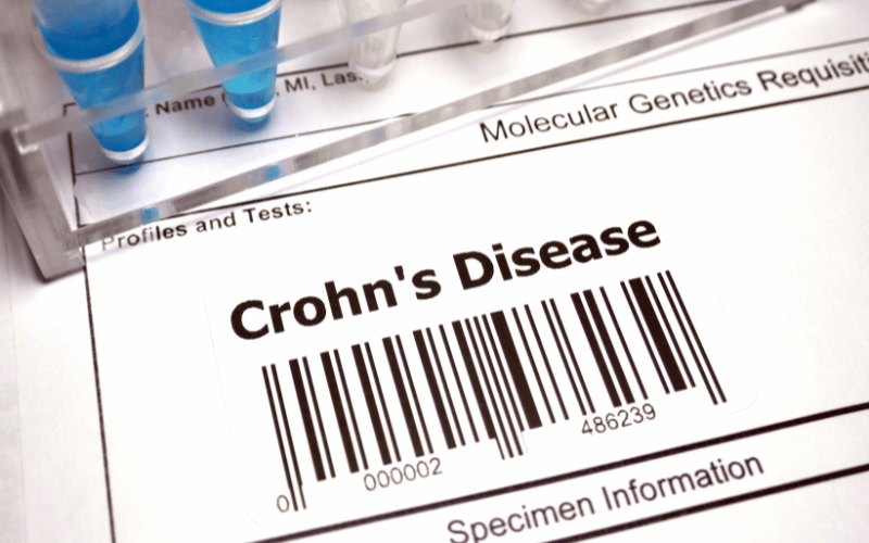 Understanding the Subtle Onset of Crohn's Disease in Children