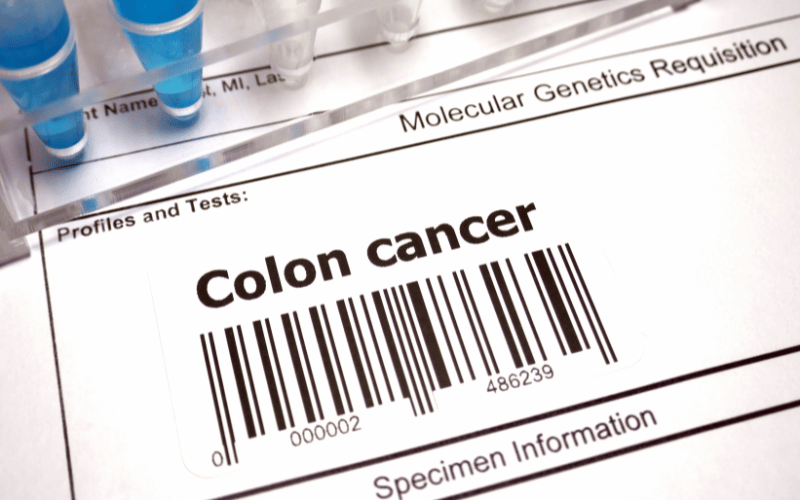Understanding the Subtle Signs 10 Symptoms of Stage 1 Colorectal Cancer