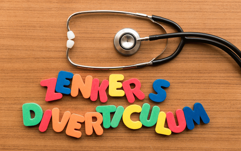 Unraveling Zenker's Diverticulum