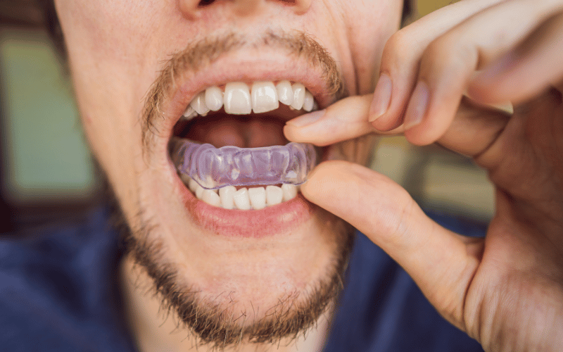 Unraveling the Mystery of Bruxism