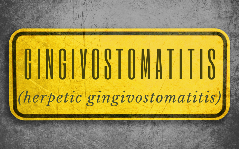 Gingivostomatitis Identifying 10 Key Symptoms in Kids