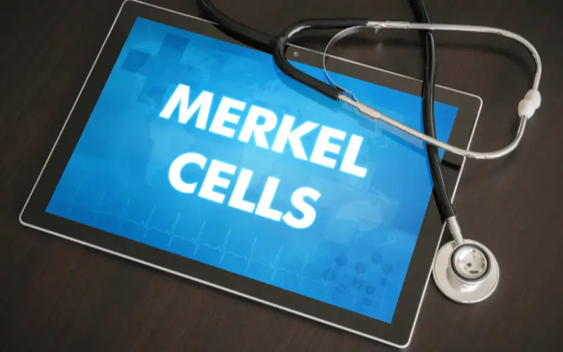 10 Pivotal Points on Merkel-cell Carcinoma The Life Expectancy Discussion