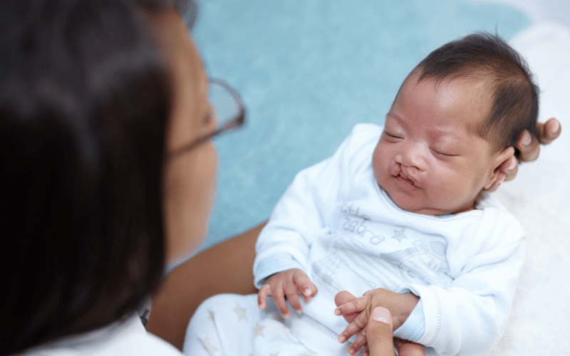 Cleft Palate Origins Five Key Causes to Know