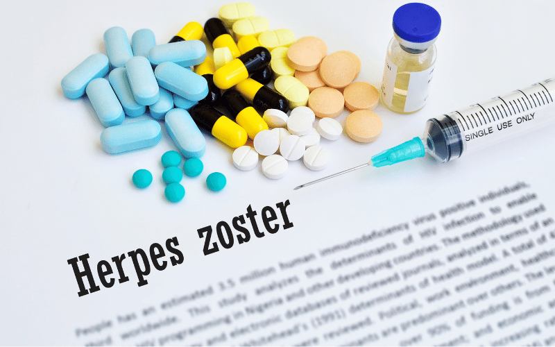 Herpes Zoster Exposed Shingles 10 Facts You Can't Ignore