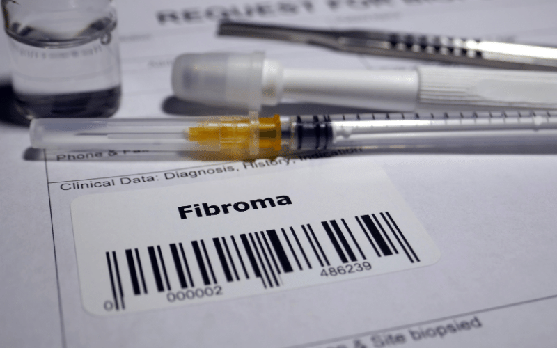 Monitoring for Fibroma 10 Key Indicators to Recognize