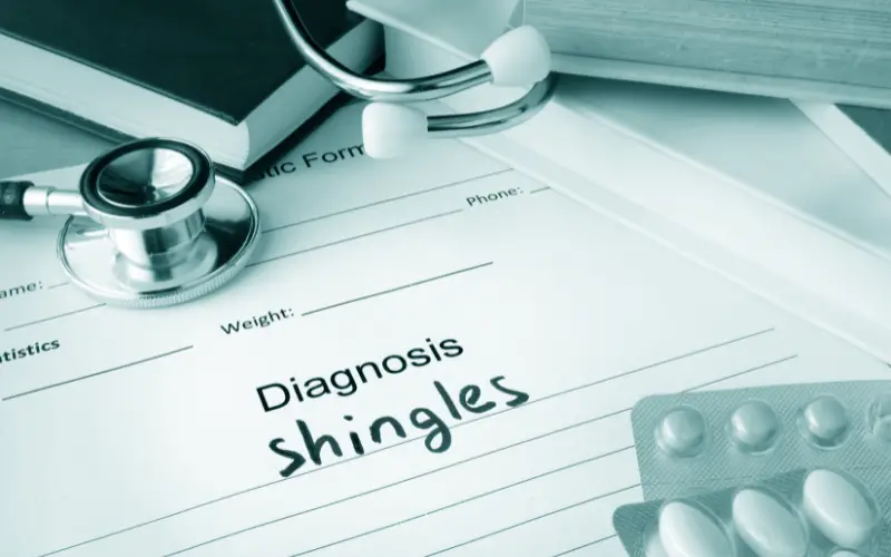 Shingles and its Progression An Informed Perspective on its 4 Stages