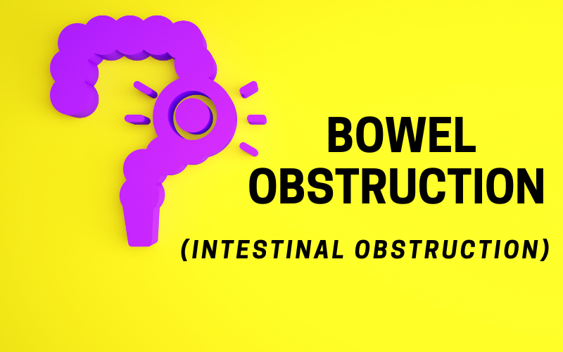 The Big Ten Leading Causes Behind Intestinal Obstruction