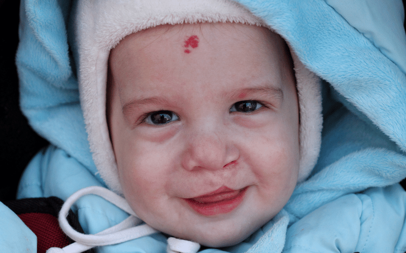 The Cleft Lip Story 15 Details that Matter