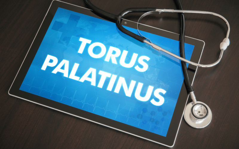 Top 10 Symptoms of Torus Palatinus Demystifying the Dental Phenomenon