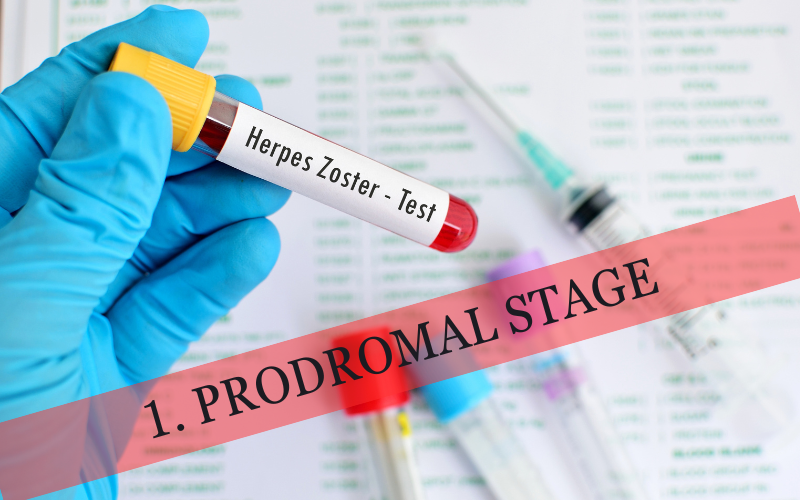 Prodromal Stage The Silent Alarm of Shingles