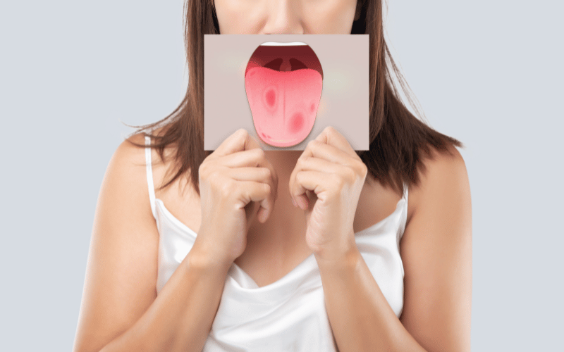 Red or Pink Lesion on the Tongue MRG's Visible Signature