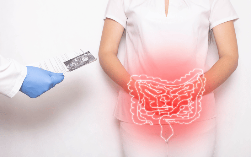 10 Alarming Symptoms of Toxic Megacolon You Shouldn't Ignore