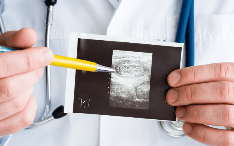 10 Crucial Symptoms of Intussusception in Children Every Parent Should Recognize