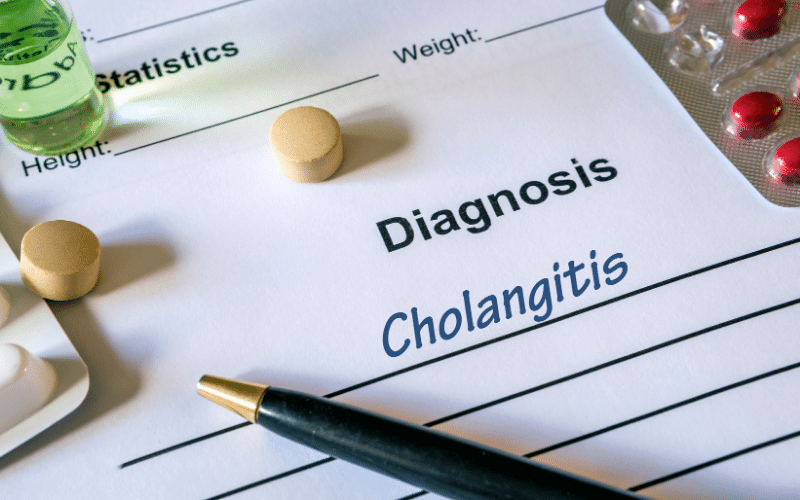 10 Important Facts About Primary Biliary Cholangitis (PBC) Prognosis Every Patient Should Know