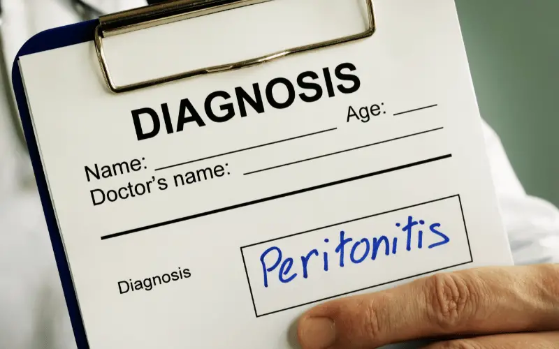 15 Vital Facts About Peritonitis Everything You Need to Know
