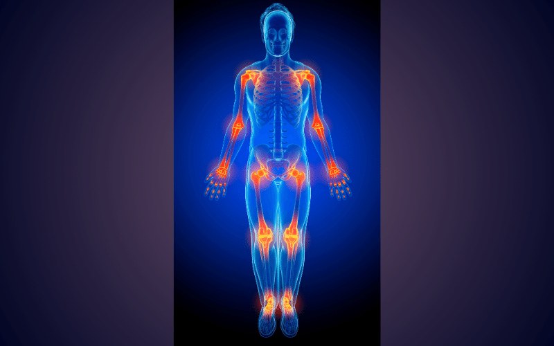 Swollen and Painful Joints Malabsorption's Unassuming Manifestation